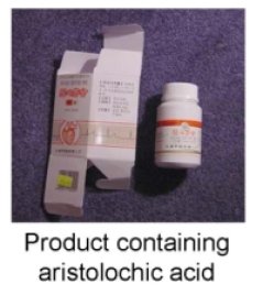 aristolochic acid